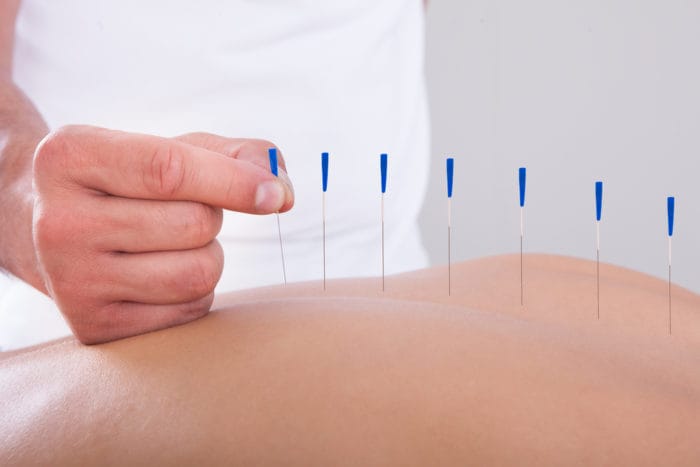 akupunktur ağrıyı hafifletir