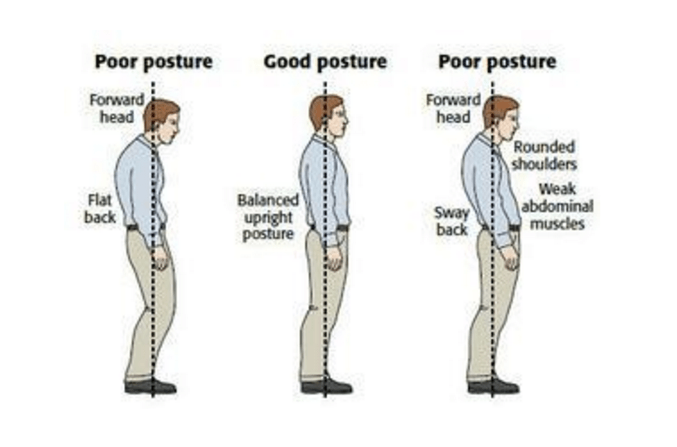 Resim kaynağı: http://www.thephysiocompany.com/blog/stop-slouching-postural-dysfunction-symptoms-causes-and-treatment-of-bad-posture
