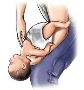 Bebekleri boğmaya yardımcı adımlar (4-5) kaynak: www.webmd.com
