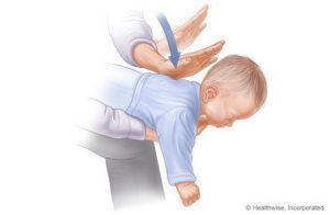 Bebekleri boğmaya yardımcı adımlar (1-3) kaynaklar: www.webmd.com