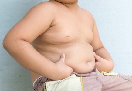 çocuklarda obezite