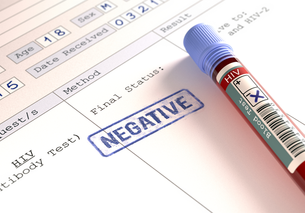 Negatif HIV testi sonuçlarının anlamı