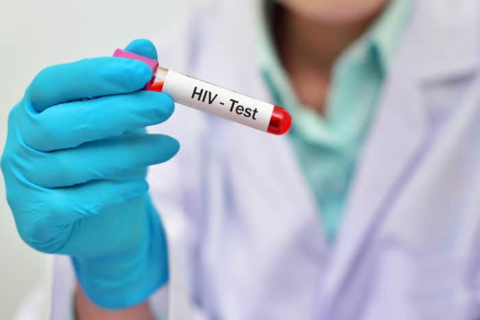HIV kan testi